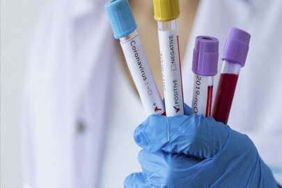 Sağlık Bakanlığı açıkladı! Koronavirüse karşı yeni tedbirler